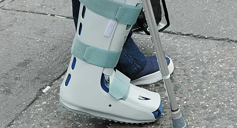 Artificial Limbs